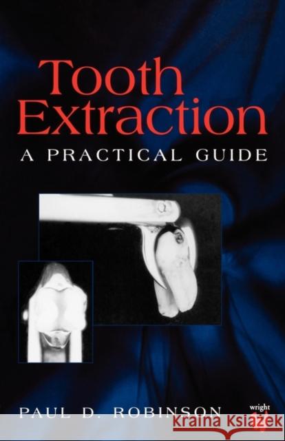 Tooth Extraction : A Practical Guide Paul D. Robinson 9780723610717
