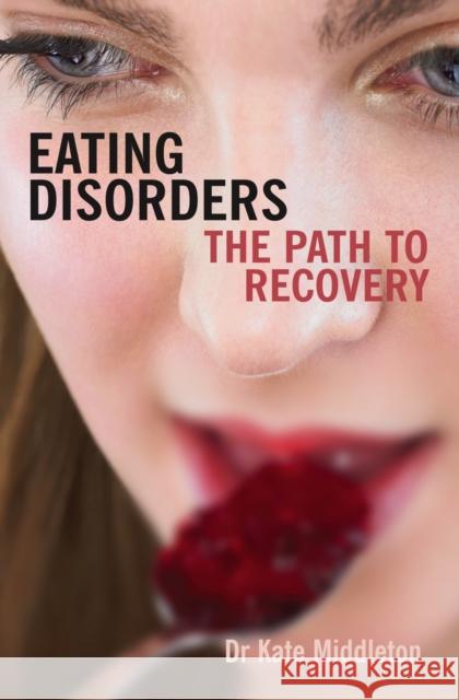 Eating Disorders Middleton, Kate 9780745952789 0
