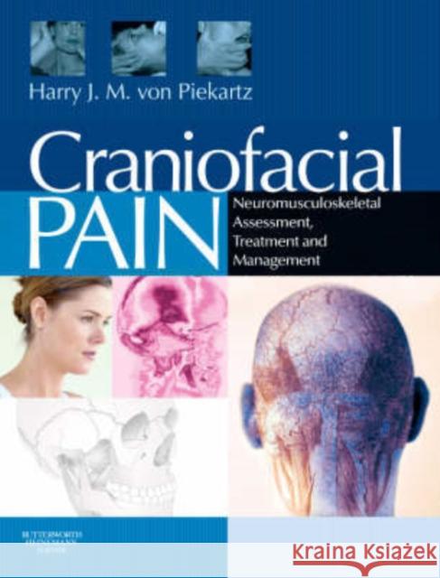 Craniofacial Pain: Neuromusculoskeletal Assessment, Treatment and Management Von Piekartz, Harry J. M. 9780750687744 Butterworth-Heinemann