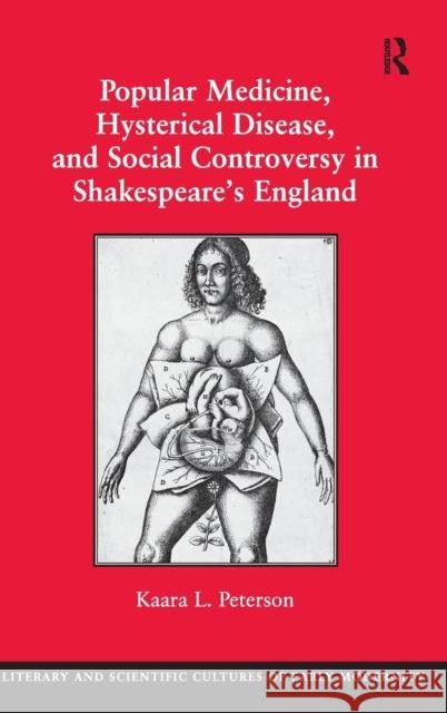 Popular Medicine, Hysterical Disease, and Social Controversy in Shakespeare's England Kaara Peterson   9780754669937 Ashgate Publishing Limited