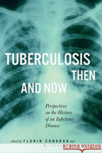 Tuberculosis Then and Now: Perspectives on the History of an Infectious Disease: Volume 37 Flurin Condrau, Michael Worboys 9780773536005 McGill-Queen's University Press