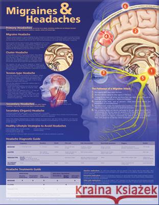 Migraines and Headaches Anatomical Chart Anatomical Chart Company 9780781776592 Lippincott Williams & Wilkins