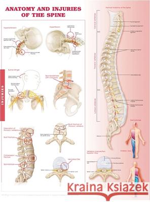 Anatomy and Injuries of the Spine : Anatomical Chart Anatomical Chart Com 9780781786669 ANATOMICAL CHART COMPANY
