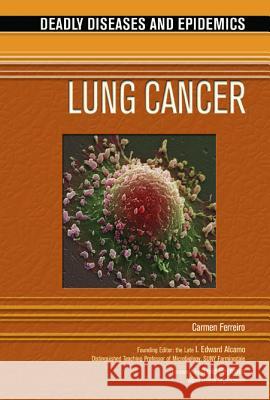 Lung Cancer Carmen Ferreiro I. Edward Alcamo David Heymann 9780791089378