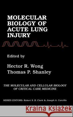Molecular Biology of Acute Lung Injury Hector R. Wong Thomas P. Shanley Hector R. Wong 9780792374343 Springer Netherlands