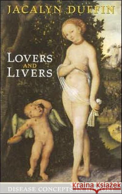 Lovers and Livers: Disease Concepts in History Duffin, Jacalyn 9780802038050 University of Toronto Press