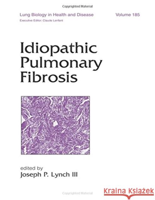 Idiopathic Pulmonary Fibrosis Lynch III Lync Joseph P. Lync Joseph Lynch 9780824740733