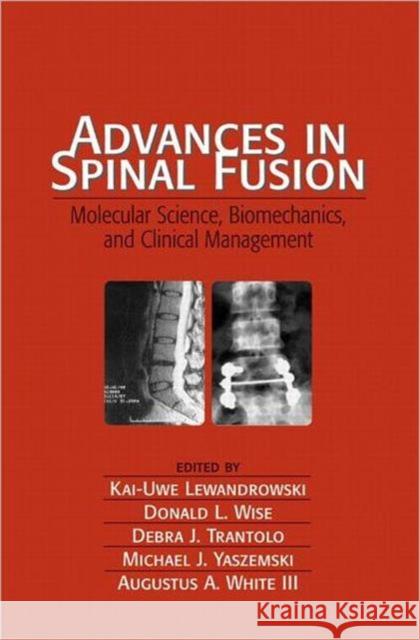 Advances in Spinal Fusion: Molecular Science, Biomechanics, and Clinical Management Lewandrowski, Kai-Uwe 9780824743109 CRC