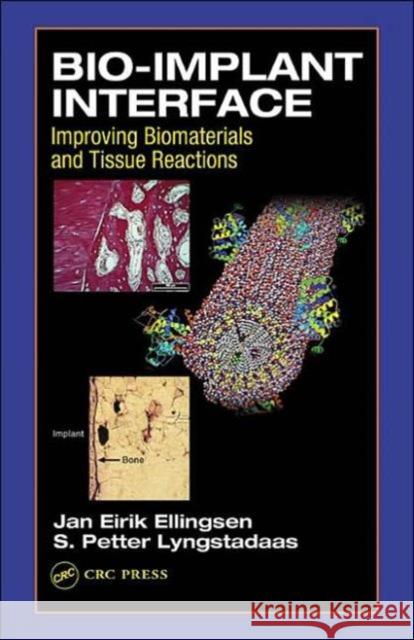 Bio-Implant Interface : Improving Biomaterials and Tissue Reactions J. E. Ellingsen Jan Eirik Ellingsen S. Petter Lyngstadaas 9780849314742 CRC Press