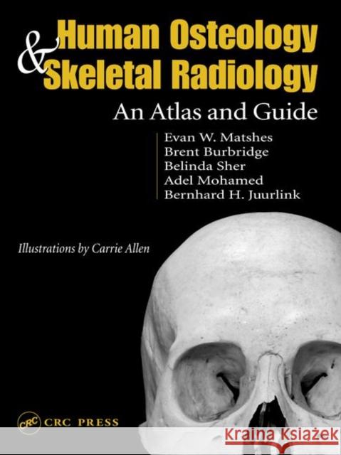 Human Osteology and Skeletal Radiology : An Atlas and Guide Evan W. Matshes Bernard Juurlink 9780849319013