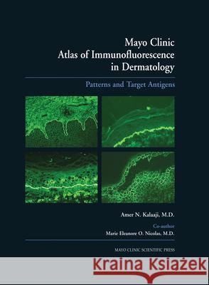 Mayo Clinic Atlas of Immunofluorescence in Dermatology: Patterns and Target Antigens Kalaaji, Amer N. 9780849375729 Mayo Clinic
