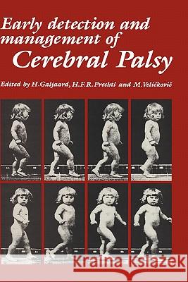Early Detection and Management of Cerebral Palsy H. Galjaard H. F. R. Prechtl M. Velickovic 9780898388909 Springer