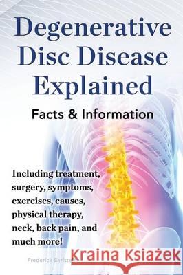 Degenerative Disc Disease Explained. Including Treatment, Surgery, Symptoms, Exercises, Causes, Physical Therapy, Neck, Back, Pain, and Much More! Fac Earlstein, Frederick 9780989658485 Nrb Publishing