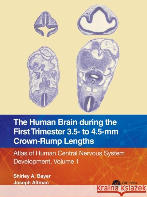 The Human Brain During the First Trimester 3.5- To 4.5-MM Crown-Rump Lengths: Atlas of Human Central Nervous System Development, Volume 1 Bayer, Shirley A. 9781032183251