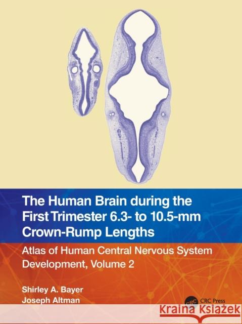 The Human Brain During the First Trimester 6.3- To 10.5-MM Crown-Rump Lengths: Atlas of Human Central Nervous System Development, Volume 2 Bayer, Shirley A. 9781032183275
