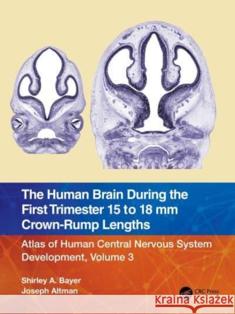 The Human Brain During the First Trimester 15- To 18-MM Crown-Rump Lengths: Atlas of Human Central Nervous System Development, Volume 3 Bayer, Shirley A. 9781032183299