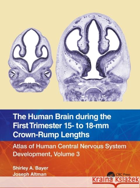 The Human Brain During the First Trimester 15- To 18-MM Crown-Rump Lengths: Atlas of Human Central Nervous System Development, Volume 3 Bayer, Shirley A. 9781032219288