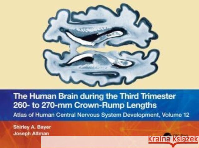 The Human Brain during the Third Trimester 260- to 270-mm Crown-Rump Lengths Joseph (Indianapolis, Indiana, USA) Altman 9781032228761
