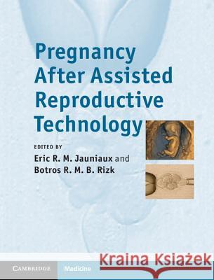 Pregnancy After Assisted Reproductive Technology Eric Jauniaux 9781107006478