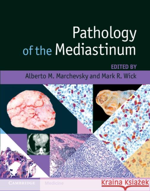 Pathology of the Mediastinum Alberto Marchevsky Mark Wick 9781107031531