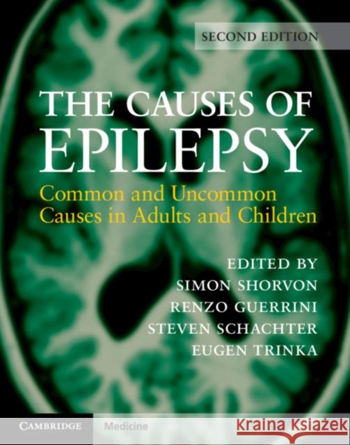 The Causes of Epilepsy: Common and Uncommon Causes in Adults and Children Simon Shorvon Renzo Guerrini Steven Schachter 9781108420754