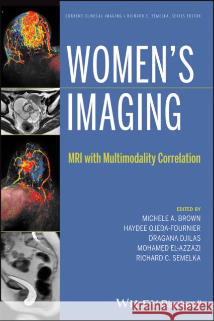 Women's Imaging: MRI with Multimodality Correlation Brown, Michele A. 9781118482841