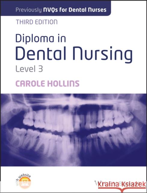 Diploma in Dental Nursing, Level 3 Hollins, Carole 9781118629482 John Wiley and Sons Ltd