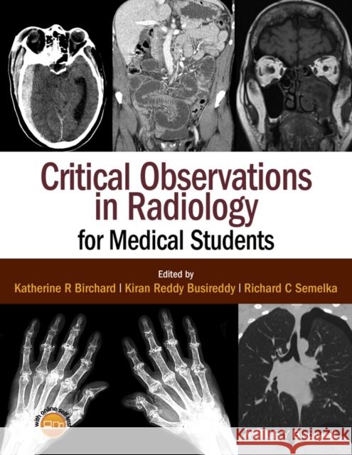 Critical Observations in Radiology for Medical Students Birchard, Katherine R.; Busireddy, Kiran Riddy; Semelka, Richard C. 9781118904718