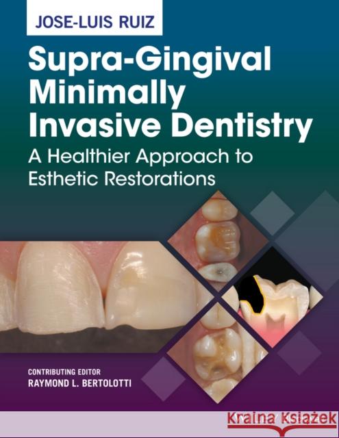 Supra-Gingival Minimally Invasive Dentistry: A Healthier Approach to Esthetic Restorations Ruiz, Jose-Luis 9781118976418 John Wiley & Sons