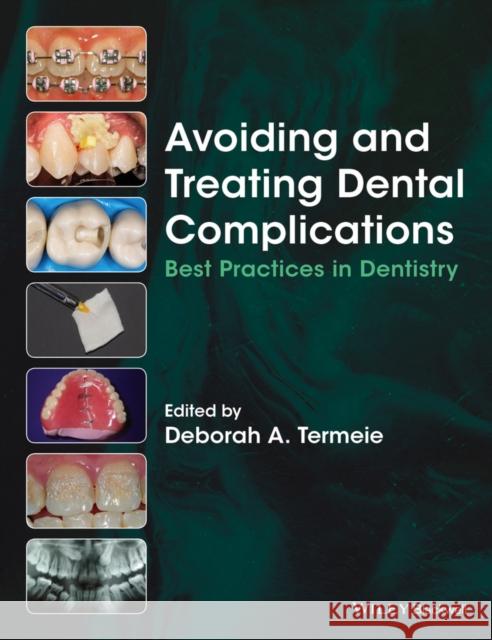 Avoiding and Treating Dental Complications: Best Practices in Dentistry Termeie, Deborah A. 9781118988022 John Wiley & Sons