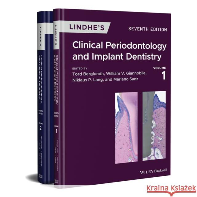 Lindhe's Clinical Periodontology and Implant Dentistry Niklaus P. Lang Tord Berglundh William V. Giannobile 9781119438885 John Wiley and Sons Ltd