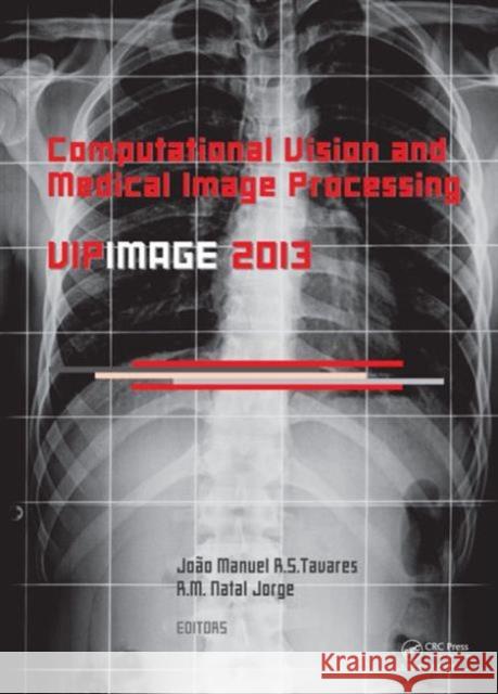 Computational Vision and Medical Image Processing IV: Vipimage 2013 Tavares, Joao Manuel Rs 9781138000810