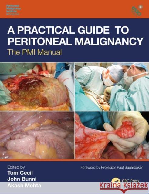 A Practical Guide to Peritoneal Malignancy: The PMI Manual Tom Cecil John Bunni Akash Mehta 9781138495111 CRC Press