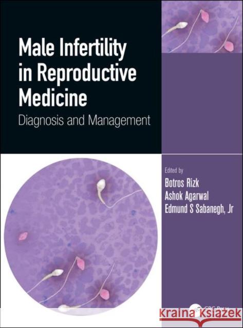 Male Infertility in Reproductive Medicine: Diagnosis and Management Botros Rizk Ashok Agarwal Edmund S. Sabaneg 9781138599291