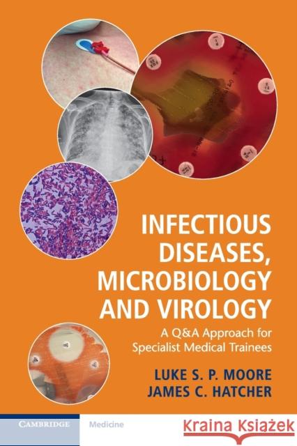 Infectious Diseases, Microbiology and Virology: A Q&A Approach for Specialist Medical Trainees Luke Moore James Hatcher 9781316609712