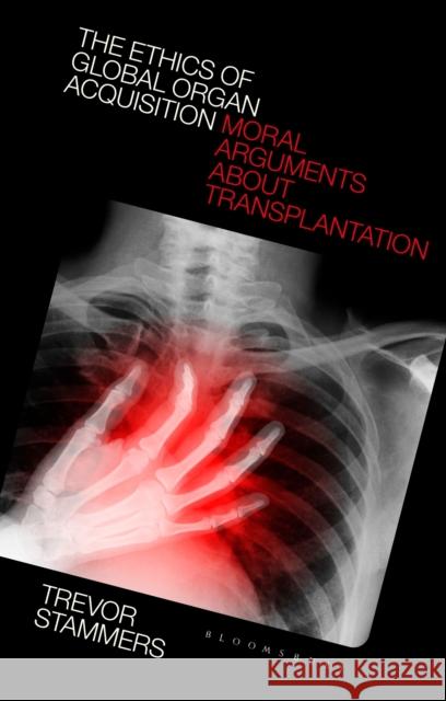 The Ethics of Global Organ Acquisition: Moral Arguments about Transplantation Trevor Stammers 9781350227187