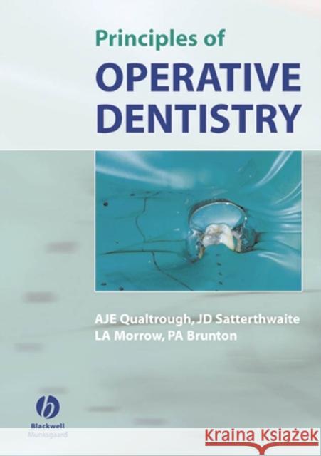 Principles of Operative Dentistry A. J. E. Qualtrough J. D. Satterthwaite L. A. Morrow 9781405118217 Blackwell Publishers