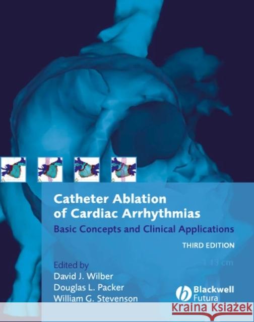 Catheter Ablation of Cardiac Arrhythmias: Basic Concepts and Clinical Applications Packer, Douglas L. 9781405131179 Blackwell Futura