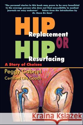 Hip Replacement or Hip Resurfacing: A Story of Choices Peggy Gabriel 9781410765659 Authorhouse