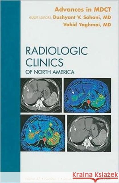 Advances in Mdct, an Issue of Radiologic Clinics: Volume 47-1 Yaghmai, Vahid 9781416063490 Saunders Book Company