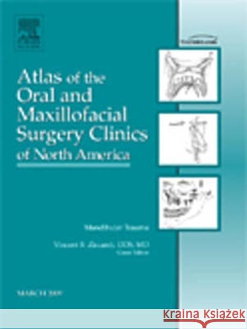Mandibular Trauma, an Issue of Atlas of the Oral and Maxillofacial Surgery Clinics: Volume 17-1 Ziccardi, Vincent B. 9781437704556 Saunders Book Company