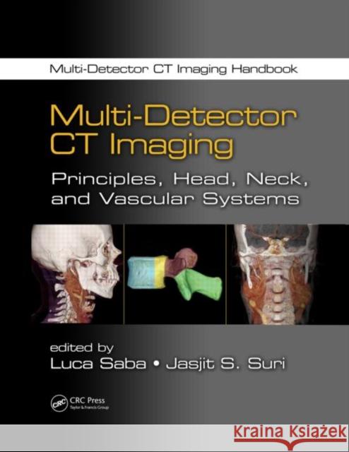 Multi-Detector CT Imaging: Principles, Head, Neck, and Vascular Systems Saba, Luca 9781439893807