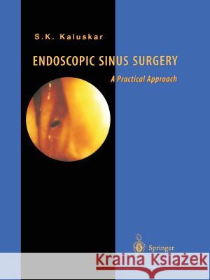 Endoscopic Sinus Surgery: A Practical Approach Kaluskar, Shashikant K. 9781447112358 Springer