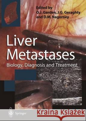 Liver Metastases: Biology, Diagnosis and Treatment O. James Garden James G. Geraghty David M. Nagorney 9781447115083 Springer