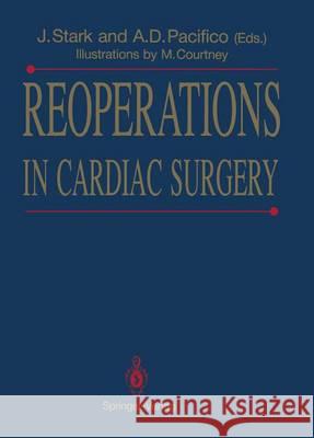 Reoperations in Cardiac Surgery Jarda Stark Al Pacifico M. Courtney 9781447116905 Springer