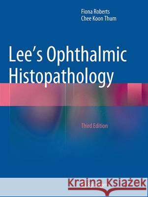 Lee's Ophthalmic Histopathology Fiona Roberts Chee Koon Thum 9781447171171
