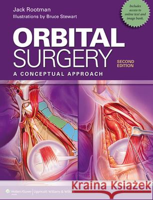 Orbital Surgery: A Conceptual Approach Rootman, Jack 9781451100105 LIPPINCOTT WILLIAMS & WILKINS