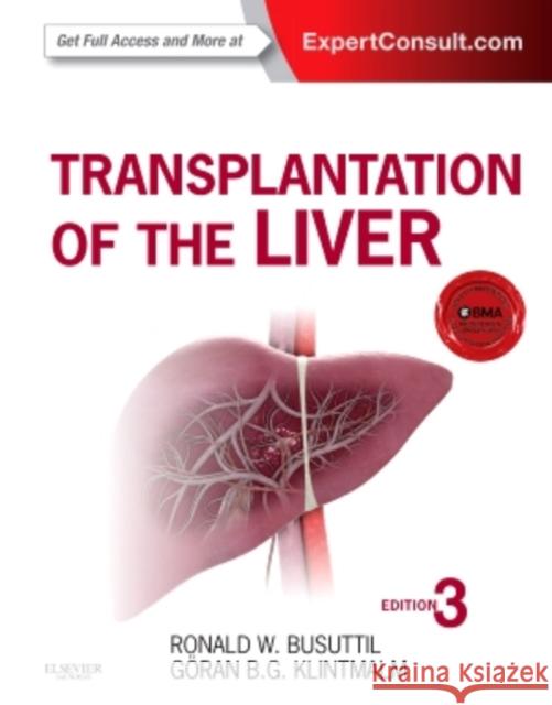 Transplantation of the Liver Ronald Busuttil 9781455702688 Elsevier Saunders