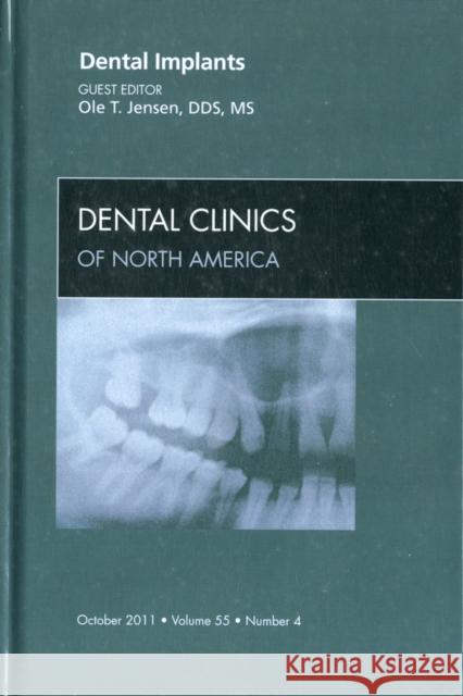 Dental Implants, an Issue of Dental Clinics: Volume 55-4 Jensen, Ole 9781455727650 The Clinics: Dentistry