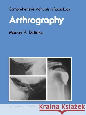 Arthrography M. K M. K. Dalinka 9781461260592 Springer